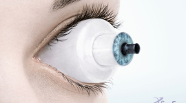The Eye