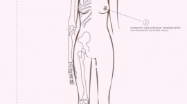 Cancer et travail