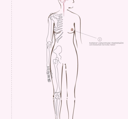 Cancer et travail