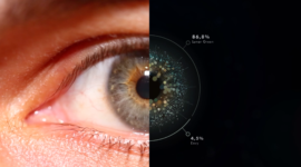 Eye Am Unique