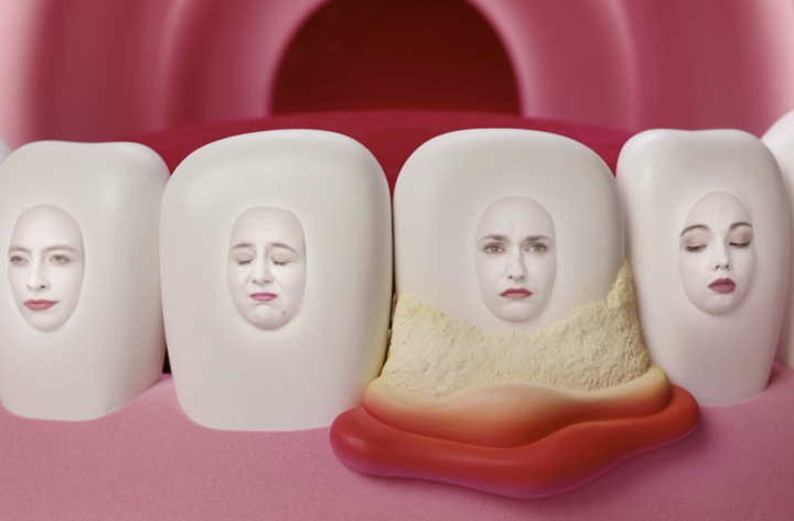 M&rsquo;T dents